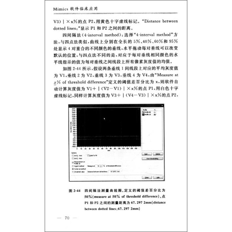 Mimics软件临床应用:计算机辅助外科入门技术