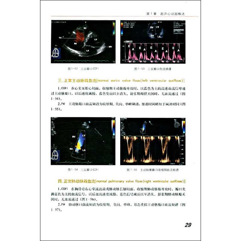 识心血管疾病超声; 心血管超声诊断学图解; m型超声心动图