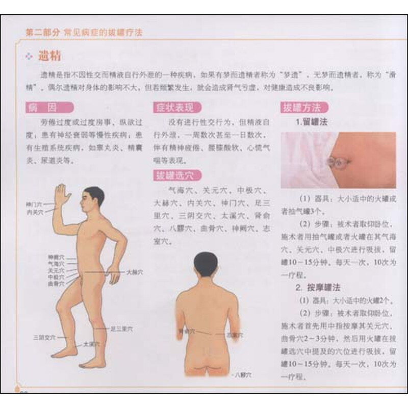 怎么拔罐图解_拔罐后颜色图解,后背拔罐的颜色图解 ...