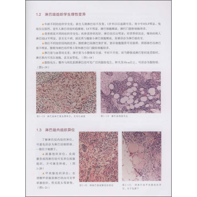 淋巴瘤病理诊断图谱