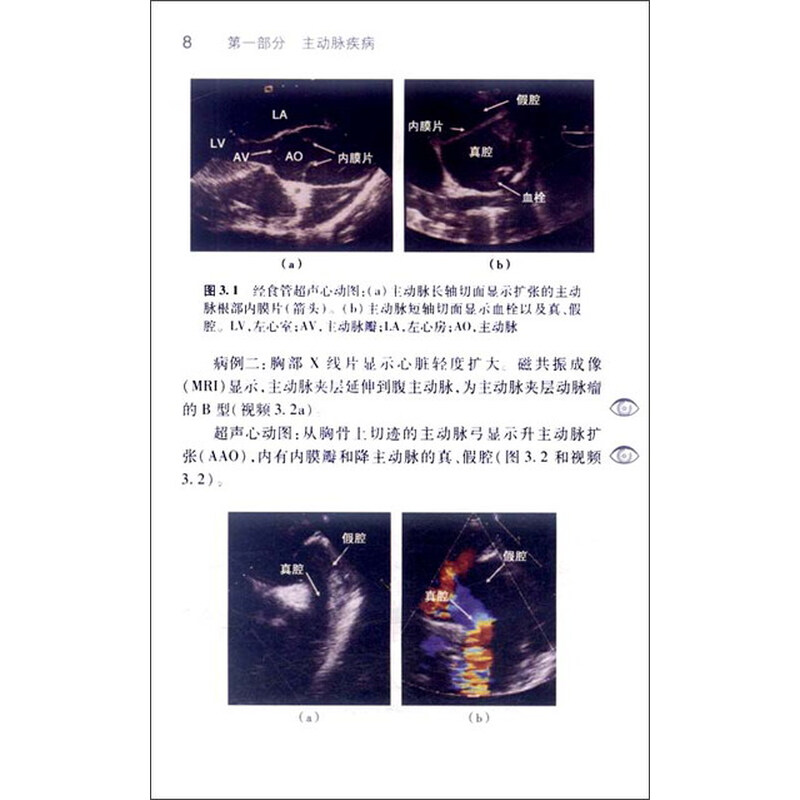 医学 临床医学 实用超声心动图手册 第97章 三维超声心动图测量左,右
