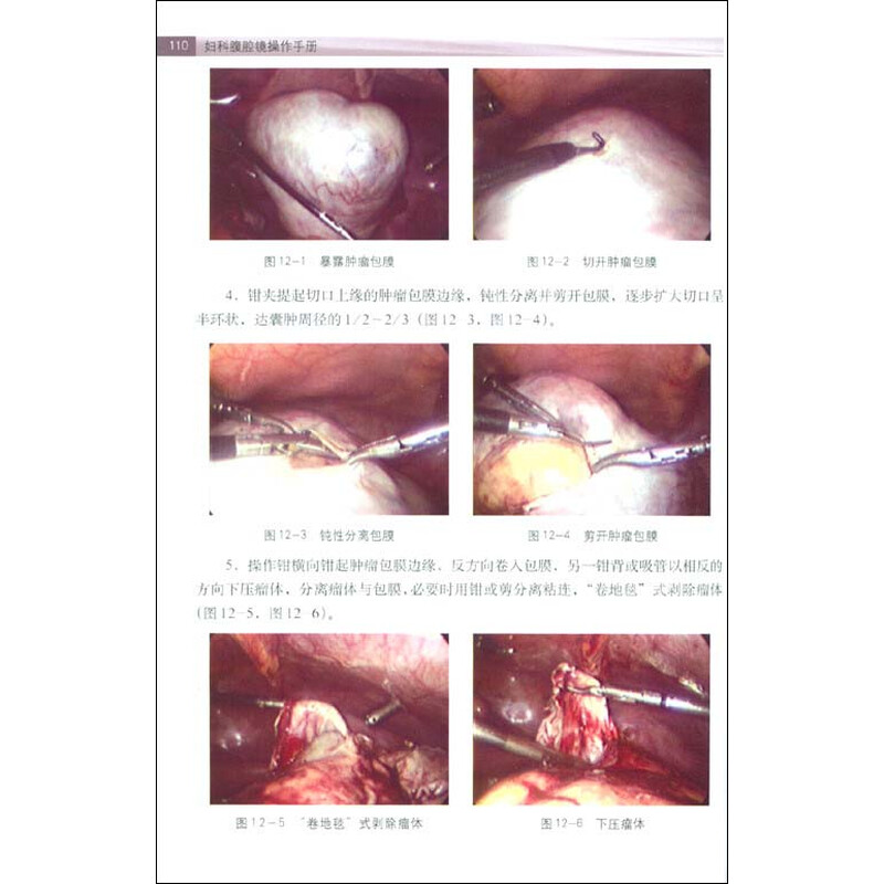 《妇科腹腔镜操作手册(附赠DVD光盘1张)》(李光仪