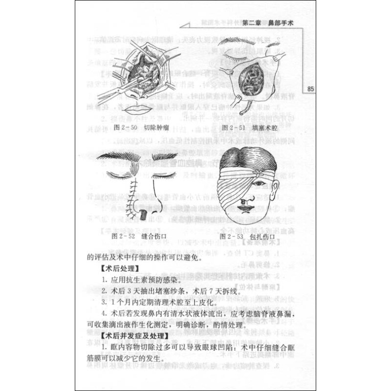 参考信息(第九节 颈外动脉结扎术; 耳前瘘管手术; 鳃裂瘘
