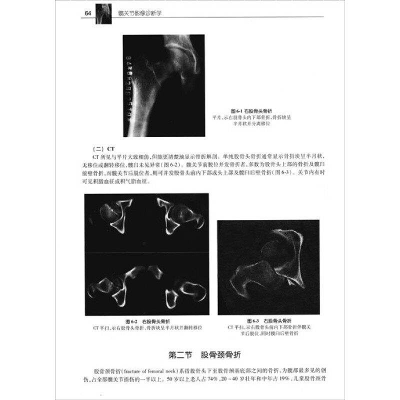 全书共分十四章,插图500幅,除介绍髋关节的应用解剖,x线,ct和mri检查