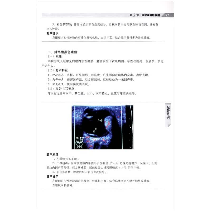 经直肠超声/405 第三节 经阴道超声/406 第四节 经食管超声心动图/407