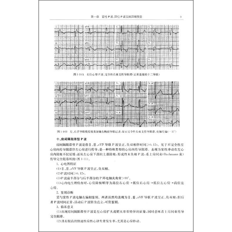 医学 内科学 浙江大学出版社 临床心电图详解与诊断 编辑推荐