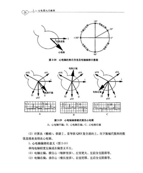 心电图从入门到精通系列:心电图入门教程