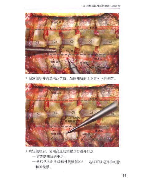 脊柱外科手术图谱