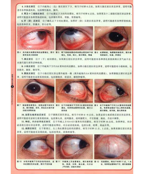 便携式眼诊挂图(附光盘1张)