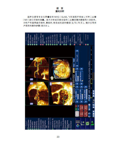 实时三维经食管超声心动图手册
