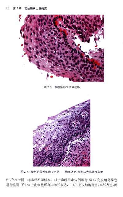 子宫颈及子宫内膜活检病理解读(翻译版) 简介,