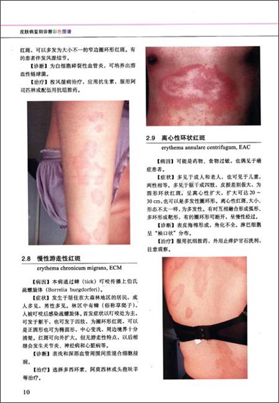 皮肤病鉴别诊断彩色图谱