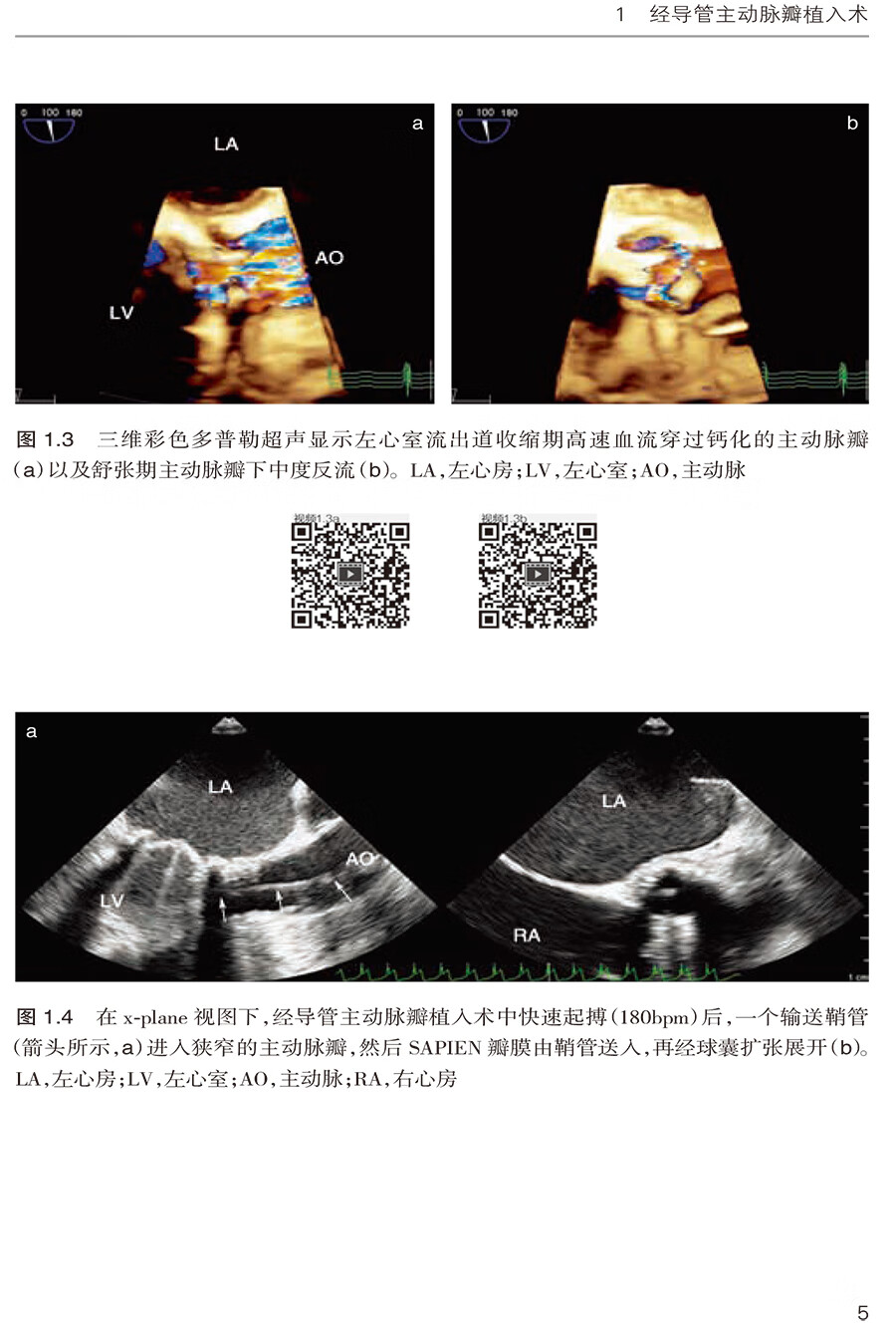 《现货 三维经食管超声心动图在结构性心脏病介入治疗中的应用 苏茂龙