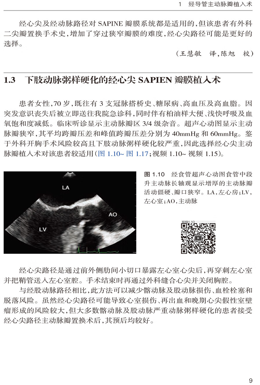 《现货 三维经食管超声心动图在结构性心脏病介入治疗中的应用 苏茂龙