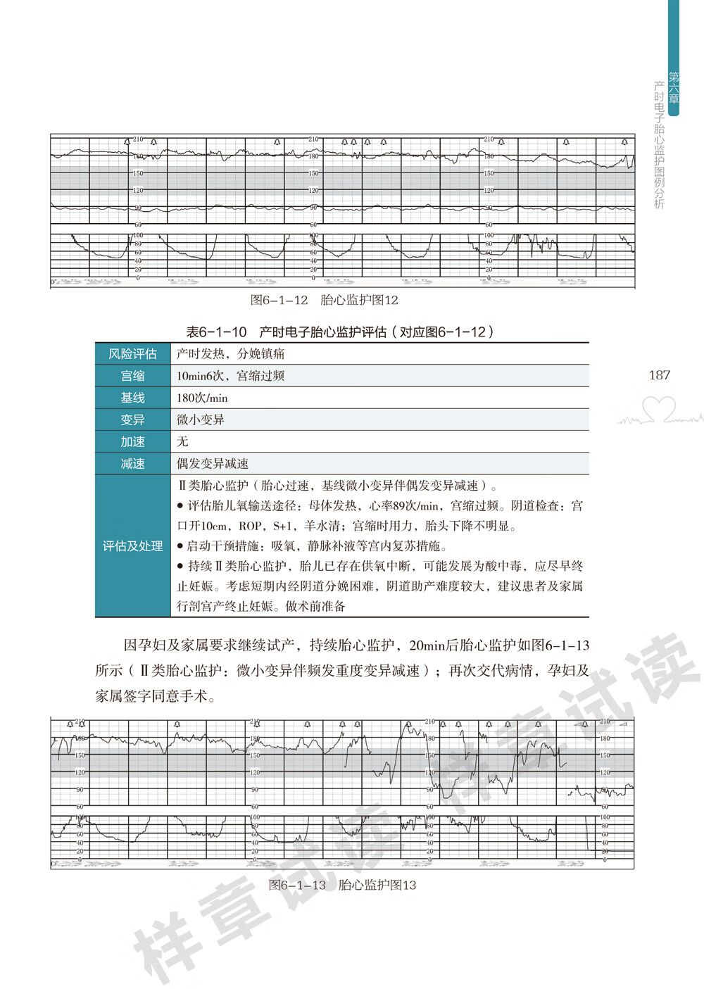 电子胎心监护书胎儿超声心动图学实用指南胎监书连续电子胎心监护规范