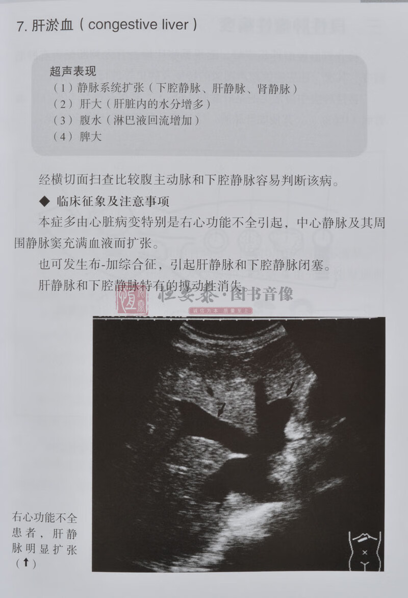 《2018修订版腹部超声读片入门中文翻译版 南里和秀著超声入门书系