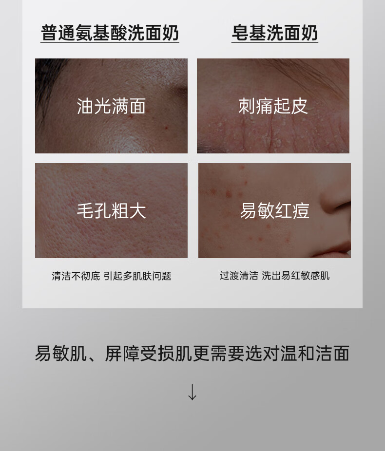 百雀羚（PECHOIN） 男士洗面奶祛黑头清洁氨基酸洁面乳控油去油温和冰爽洁面膏100g 【温和控油】氨基酸洁面乳150ml