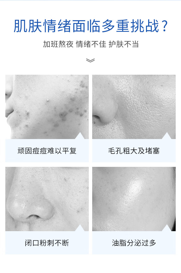 博乐达水杨酸祛痘面膜超分子清洁闭口粉刺凝胶淡痘黑头官方 【控油净肤】水杨酸面膜35g