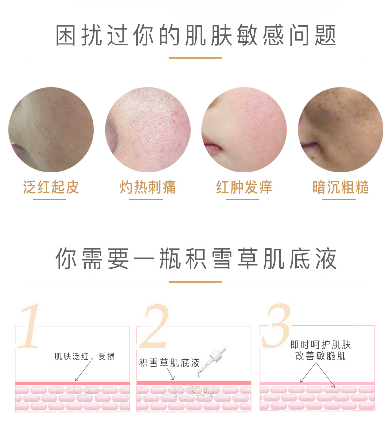 934 943/积雪草修护舒缓肌底液滋润保湿修护精华液敏感肌 2瓶