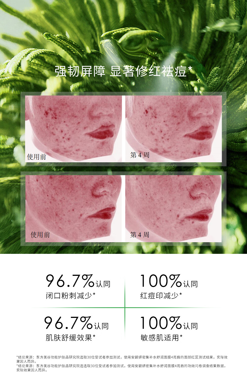 安碧妍华西积雪草舒缓修护肌肤屏障透明质酸保湿敏感肌祛痘补水面膜 1盒装（送一片到手6片）