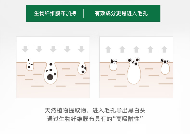 柏翠丝（Bytree's）去黑头鼻贴粉刺深度清洁器收细毛孔鼻膜导出男女黑头铲 1对补充装（不含黑头铲