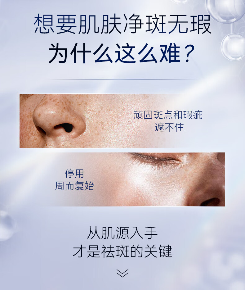RSAS祛斑美白精华 雀斑晒斑黑斑淡化斑点黑色素提亮肤色 美白祛斑精华液30ml
