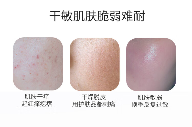 皮宝 舒缓修护特润霜大白瓶乳液面霜改善敏感泛红保湿滋润特护干敏肌 特润霜50g