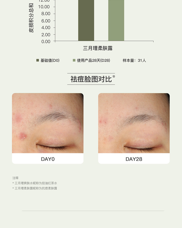 三月理 油痘肌水乳红茶控油抗痘套装舒缓清爽平衡水油补水学生男女 控油祛痘水乳2件套