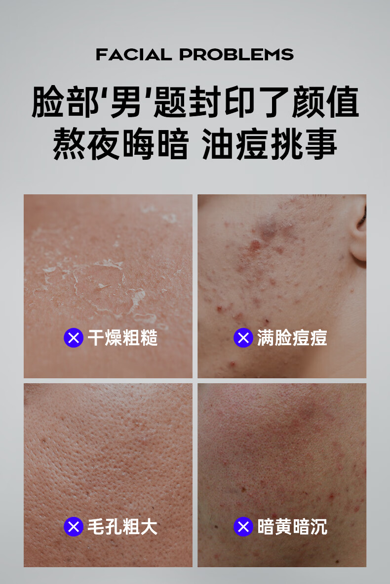 泉帝（QUANDI）清肌纯美白净痘精华液收敛毛孔护肤品 泉帝男士精华液帝泉 quan帝 泉帝精华+水乳套装