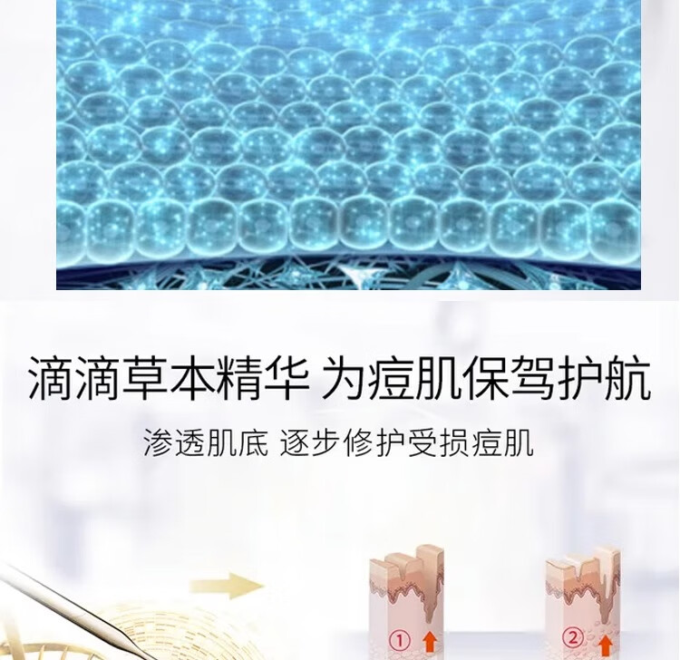 NHFOUYOU祛痘精华液祛痘膏去闭口粉刺痘坑痘印淡化消印收缩毛孔精华液 一瓶【30ml】建议按疗程使用