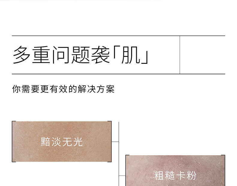 ddg果篮精华果酸杏仁酸控油亮肤去角质闭口面部提亮舒缓修护 30g（享同款5g）