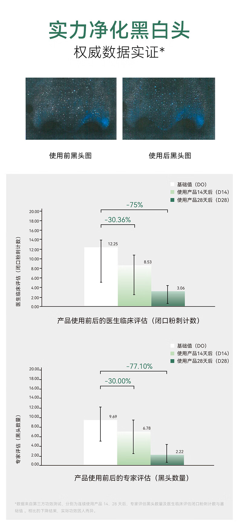 安修泽（ONCUR）清洁泥膜 水杨酸果酸涂抹面膜深层清洁毛孔控油去黑头白泥 组套装240g
