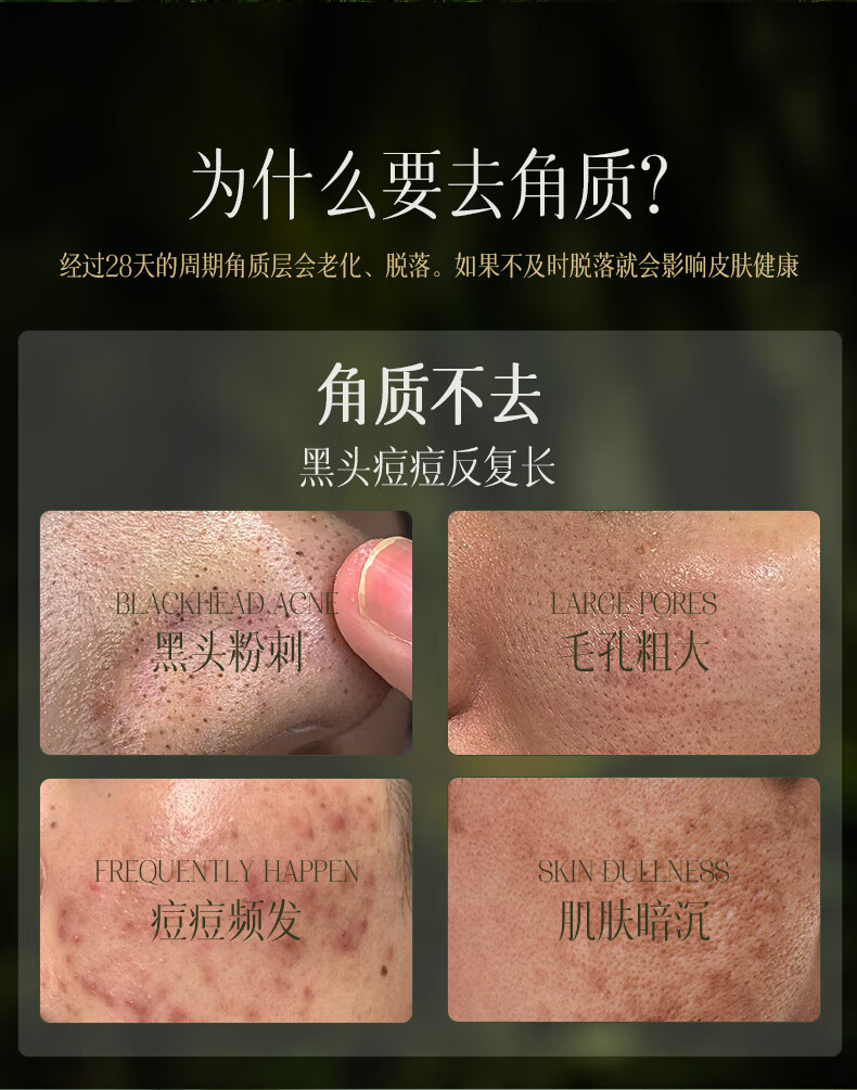 iFACE澳洲进口去角质去死皮面部深层清洁啫喱收缩毛孔去黑头脸部男女 磨皮去角质啫喱160ml