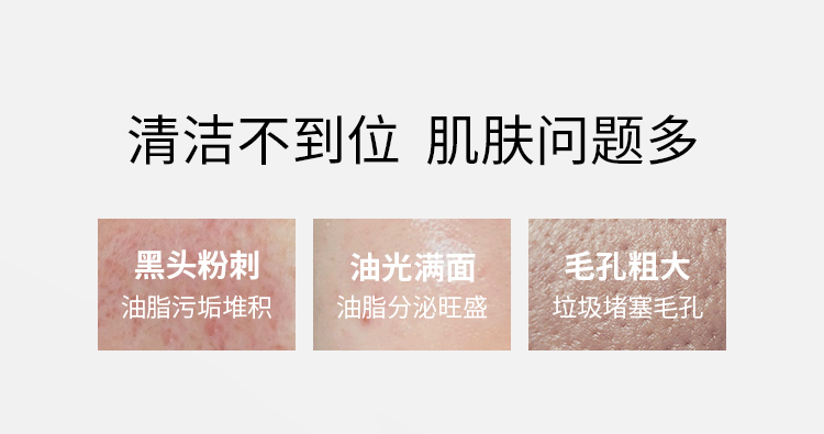 歌如兰清洁泥膜控油收缩毛孔去黑头去角质涂抹式面膜白泥油皮护肤 618买 【划算】1支(赠小样2颗+面膜刷)