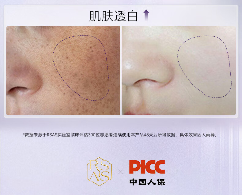 RSAS祛斑美白精华 雀斑老年斑晒斑黑斑黄褐斑 淡化斑点黑色素提亮肤色 祛斑美白精华30ml