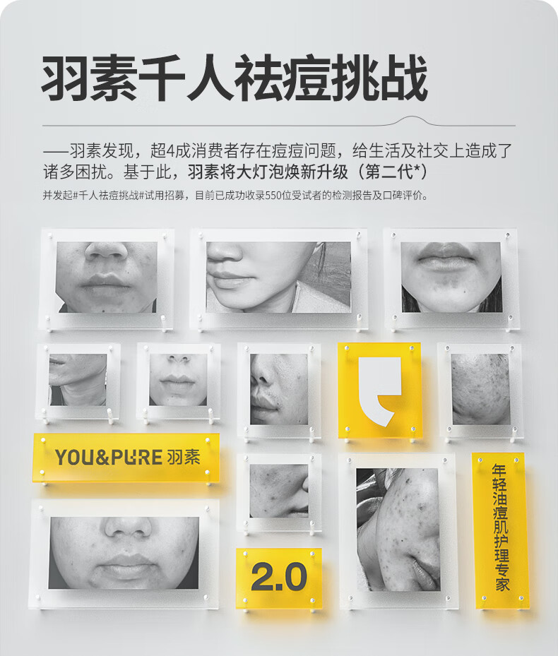 羽素祛痘大灯泡精华液Ⅱ救急突发痘褪红去闭口粉刺胶态硫祛痘控油精华 15ml