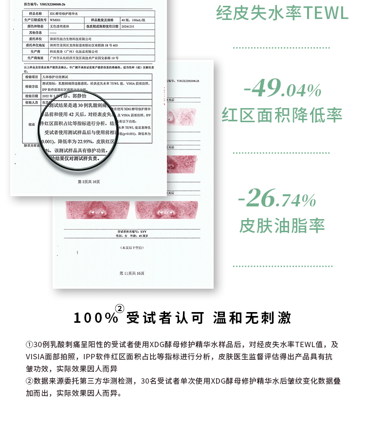 XDG第三代酵母益生菌控油修护精华水混油皮痘肌学生女爽肤水男护肤品 第三代益生菌精华水100ml