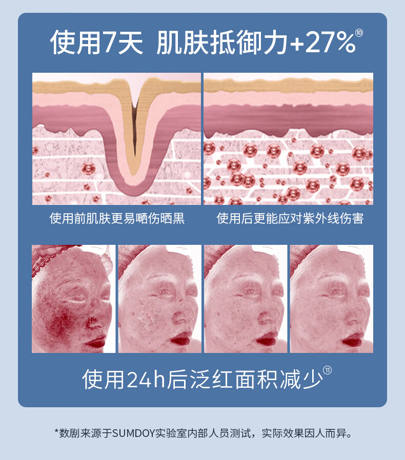 SUMDOY 日本进口晒后修复芦荟胶急救凝胶全身体皮肤屏障脸部晒黑伤修护 200g（舒缓深层修护）