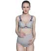 Pill Mummy Breast Breast Underwear Set Pregnant Women Underwear Striped Lace Front Bake Breast Underwear B7076 White Underglass 90C