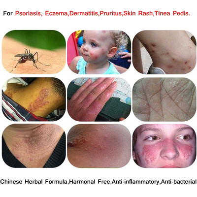 ZUDAIFU 15g Skin Care Chinese Herbal Medicine Cream Rich in Herb Extract Essence Product Antibacterial Relief Pruritus Eczema Crea
ZUDAIFU 15g Skin Care Chinese Herbal Medicine Cream Rich in Herb Extract Essence Product Antibacterial Relief Pruritus Eczema Crea