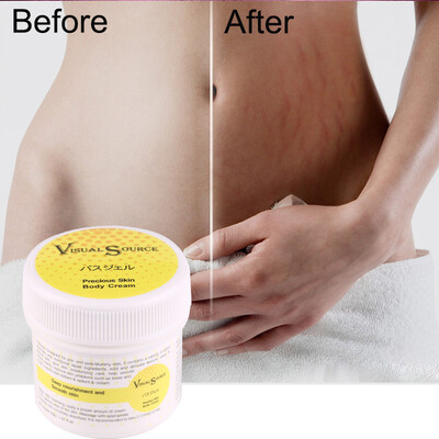 Smooth Skin Cream For Stretch Marks Scar Removal To Maternity Skin Repair Body Cream Remove Scar Care
Smooth Skin Cream For Stretch Marks Scar Removal To Maternity Skin Repair Body Cream Remove Scar Care