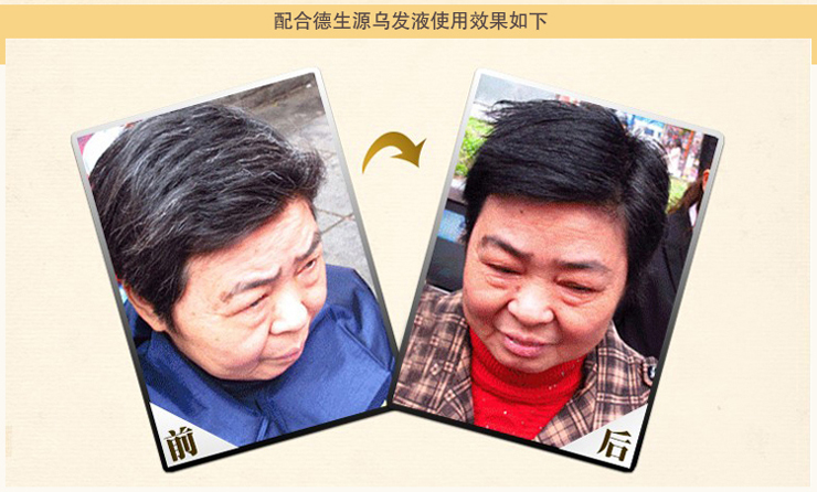 <em>白发变黑发</em>洗发水哪种好 乌发黑发洗发水牌子