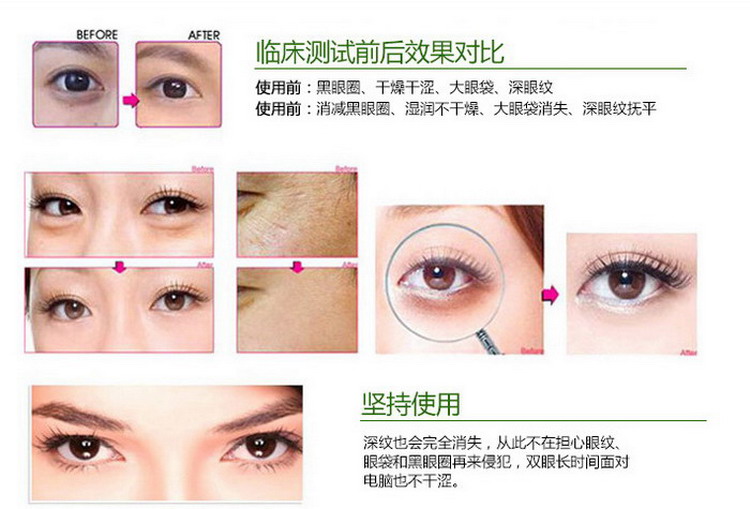 什么牌子的眼霜可以消除黑眼圈和眼部细纹?