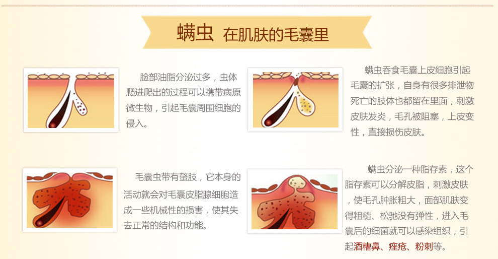 上宫庄肤螨灵洁面乳100g男<em>女士祛痘</em>