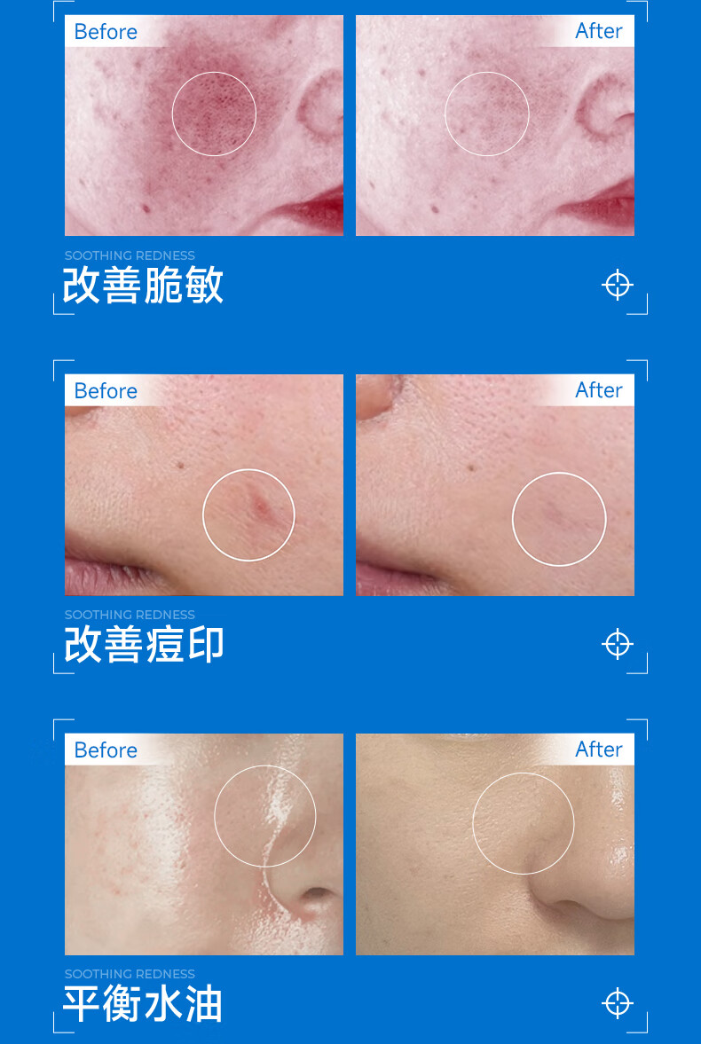 碧素堂维生素B5特安修护爽肤水 修护水120ml