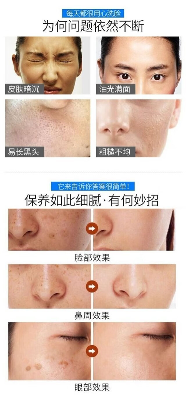 九叶草氨基酸洗面奶男女男士洗面奶除螨控油去黑头去角质收缩毛孔 1瓶装【脸上瘙痒长痘螨虫在作怪