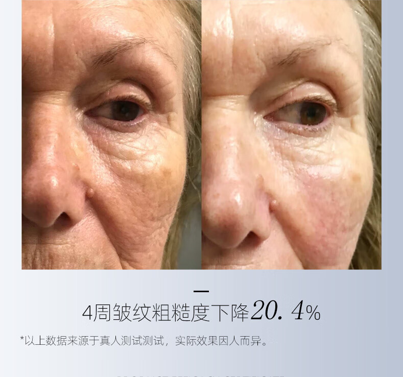 唯莉欧类肉毒多肽晚霜抗皱修护面霜护肤女补水保湿紧致 晚霜50ml*2
