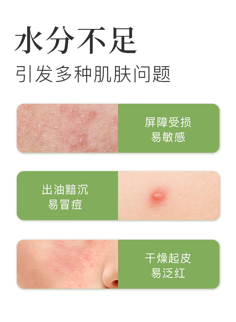 寻荟记 芦荟水保湿补水湿敷水油平衡控油化妆爽肤水护肤品男女学生300ml