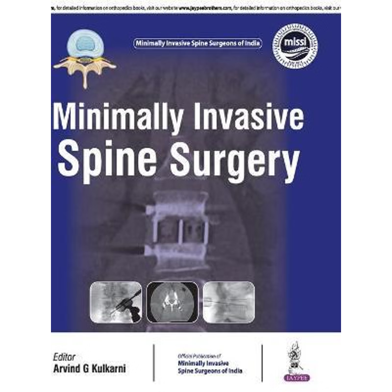 按需印刷Minimally Invasive Spine Surgery[9789352700547]