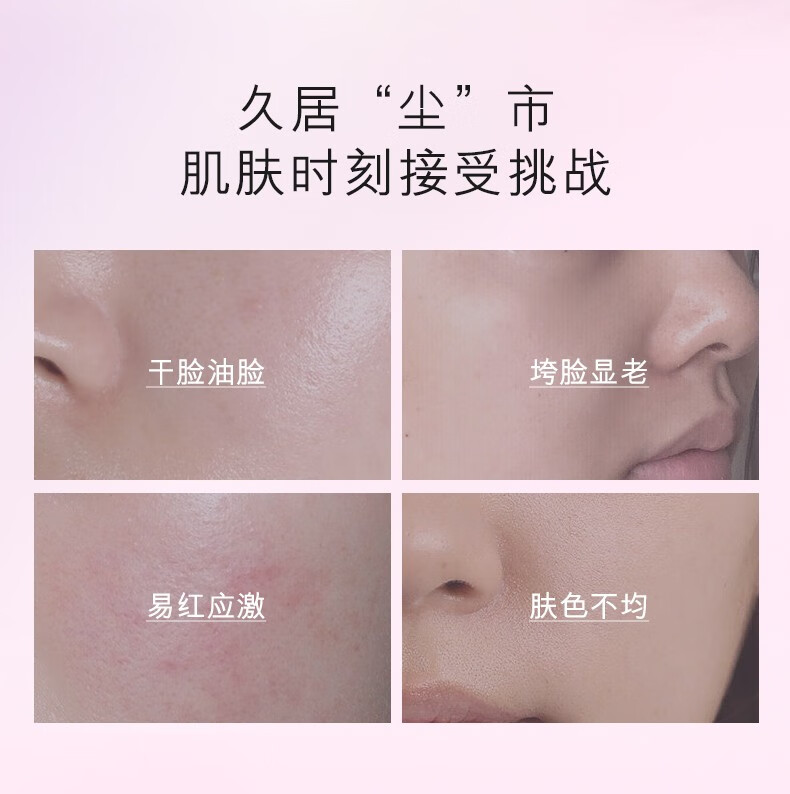 蓝尼芳可（LANNIFANGKE）二裂酵母挚颜晶透护肤水乳组合 男女士爽肤水乳液护肤品 2件套